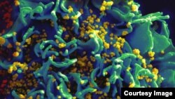 A scanning electron micrograph shows HIV particles infecting a colorized human H9 T cell. (Credit: NIAID) FILE PHOTO