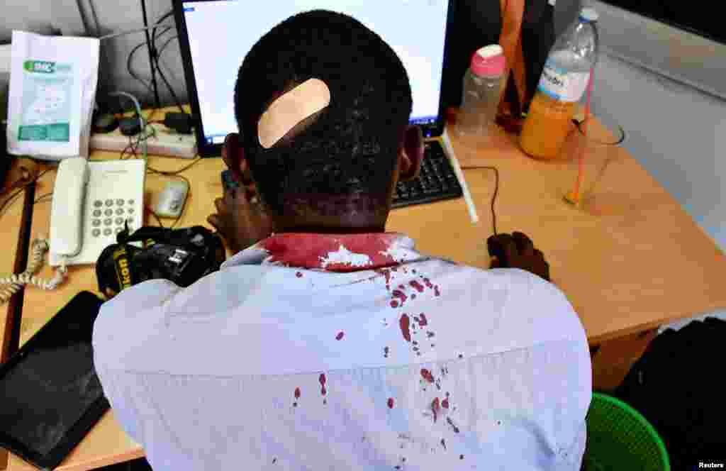 Paul Murungi, a journalist working with The New Vision newspaper is seen at his desk after he was injured while on reporting duty following an attack by security officials, outside the United Nations Human Rights offices, in Kampala, Uganda.
