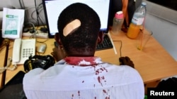 FILE - Paul Murungi, a journalist working with The New Vision newspaper is seen at his desk after he was injured while on reporting duty following an attack by security officials, outside the UN Human Rights offices, in Kampala, Uganda, Feb. 17, 2021.