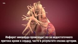 Сердечные приступы у женщин