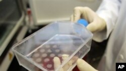 Vekolîna liser Şaneyên Reha Jiyanê