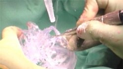 Doctors Call World's First Full Face Transplant A Resounding Success