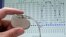A pacemaker is shown against the backdrop of a cardiological graph in Potsdam, Germany, February 26, 2004