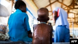 FILE - A 5-year-old boy with a severe malnutrition rests on a bed at the Aweil State Hospital, in Northern Bahr El-Gazhal, South Sudan, Oct. 9, 2015.