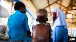 FILE - A 5-year-old boy with severe malnutrition rests on a bed at the Aweil State Hospital in Northern Bahr El-Gazhal, South Sudan, Oct. 9, 2015 