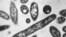 FILE - Legionella pneumophila bacteria, which are responsible for causing the pneumonic disease Legionnaires' disease, are seen in this 1978 electron microscope image made available by the Centers for Disease Control and Prevention.