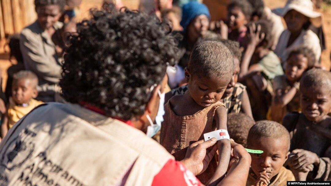 Kekeringan akibat perubahan iklim memicu semakin banyaknya anak mengalami kekurangan gizi (malnutrisi) akut di seluruh dunia, termasuk di Ambovombe, Madagaskar (foto: dok). 