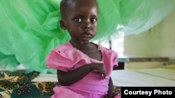 FILE - A 17-months-old child who weighed just 16 pounds when she arrived at the hospital in central Malawi, and was severely malnourished. (Oli Cohen/Save the Children)