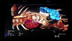 Virtual Medicine Takes Shape with Floating Body Parts