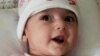 فاطمه رشاد نوزاد ۴ ماهه ایرانی دچار یک ناهنجاری نادر قلب است و قرار است در شهر پورتلند آمریکا جراحی شود