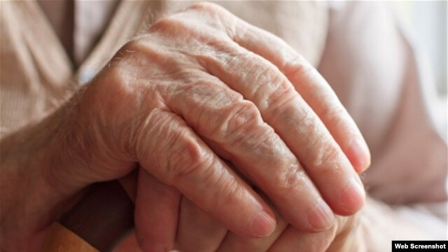 El Alzheimer es la más común de una condición condocida como demencia.