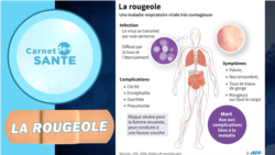 L'épidémie de rougeole qui sévit en RDC est "la pire au monde"