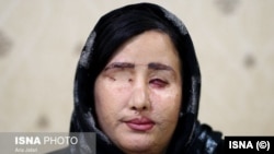 Soheila Jorkesh, one of four women attacked with acid in Iran’s Isfahan in 2014, appears in this photo published July 20, 2018, by state news agency ISNA, which interviewed her about her ongoing legal battle for justice.