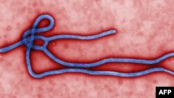 A colorized micrograph obtained March 24, 2014 from the Centers for Disease Control in Atlanta, Georgia, reveals some of the ultrastructural morphology displayed by an Ebola virus virion. (CDC/Cynthia Gold.)