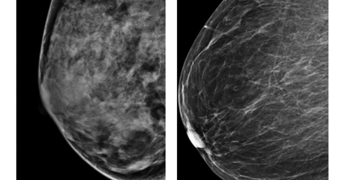 Chiroyli nipelli ayol kokraklari