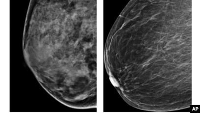 Xotin erining kozini sorsa, gunohmi yoki yoqmi?