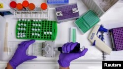 A scientist prepares protein samples for analysis in a lab at the Institute of Cancer Research in Sutton, July 15, 2013. Picture taken July 15, 2013. To match Insight CANCER-DRUGS/ REUTERS/Stefan Wermuth (BRITAIN - Tags: HEALTH SCIENCE TECHNOLOGY) - 