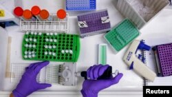 FILE - A scientist prepares protein samples for analysis, July 15, 2013. 