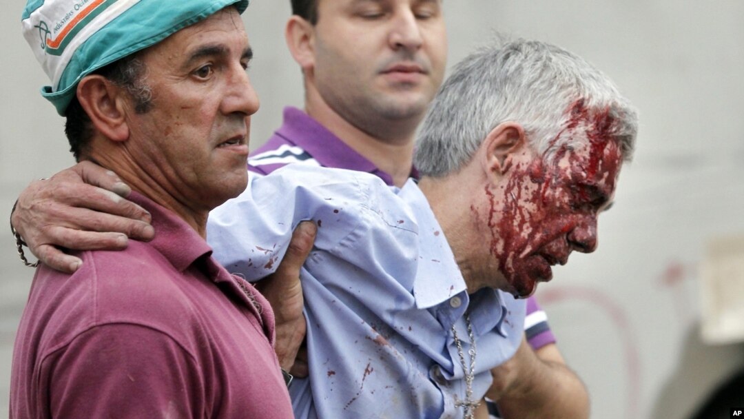 In this photo taken on Wednesday July 24 2013, train driver Francisco Jose Garzon Amo is helped by two men as he is evacuated from the site of a train accident in Santiago de Compostela, Spain.