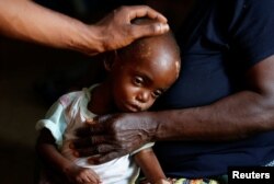 FILE - Kaba Bitika Marie, 19 months, an internally displaced and severely malnourished child receives medical attention at the Presbyterian hospital in Dibindi zone of Mbuji Mayi in Kasai Oriental Province in the Democratic Republic of Congo, March 16, 2018.