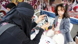 شهروند خبرنگار يمنی از تجربيات خود می گويد