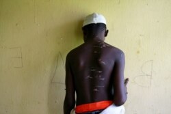 A 15 year-old-boy, one of hundreds of men and boys rescued by police from an institution purporting to be an Islamic school, reveals scars on his back at a transit camp set up to take care of the released captives in Kaduna, Nigeria, Sept. 28, 2019.