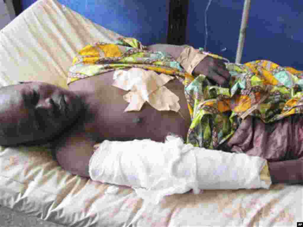 A victim of Friday's bomb blast and gun attacks lies in Murtala Muhammad specialist hospital in Kano, Nigeria Saturday, Jan. 21, 2012.