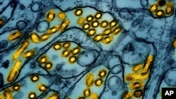 Imagen iluminada de un microscopio de electrones difundida por el Instituto Nacional de Alergias y Enfermedades Infecciosas el 26 de marzo de 2024 que muestra partículas del virus de influenza aviar A H5N1, en amarillo, en células epiteliales (azul).