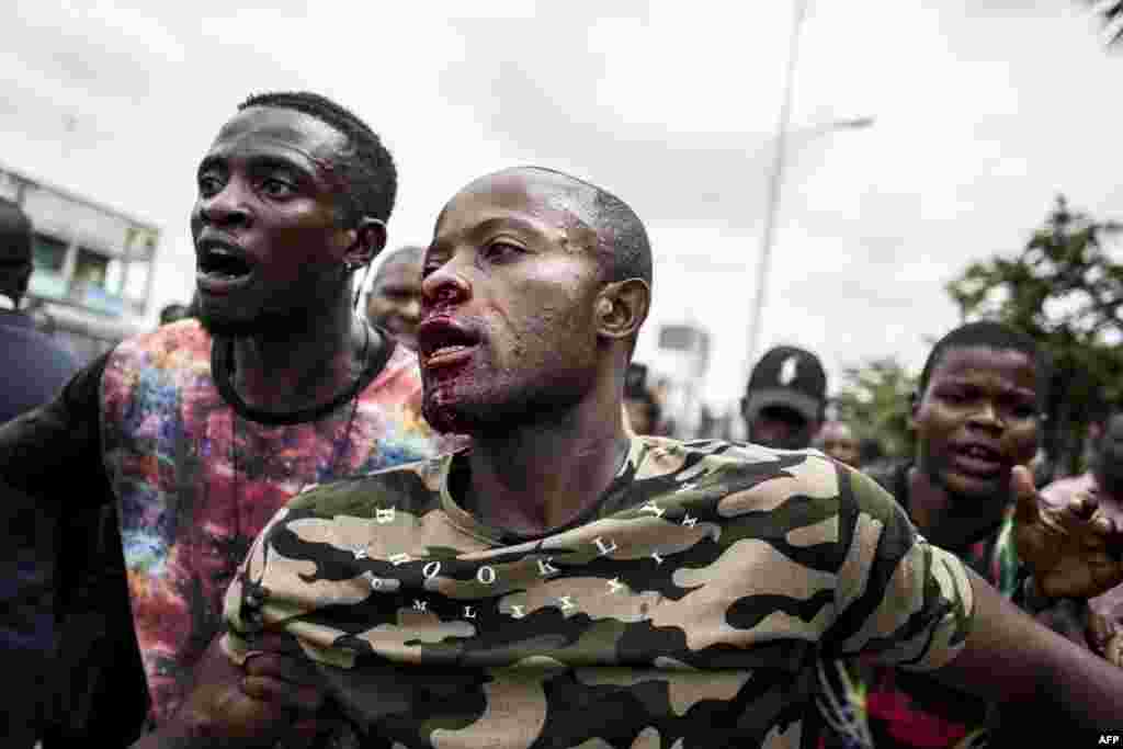 Un homme blessé au visage après les tirs de forces de sécurité congolaises, Kinshasa, RDC, le 12 janvier 2018