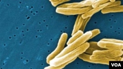 Contoh gambar bakteri mikro tuberkulosis. Sekarang dikhawatirkan bahwa jenis yang berkembang di Eropa saat ini, adalah varian yang kebal antibiotik.
