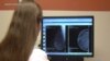 AI Machine Learning Builds 'Atlas' of 140 Breast Cancer Tumors