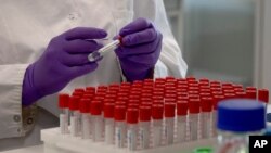 Un técnico de laboratorio pone una etiqueta en un tubo de ensayo durante una investigación sobre el coronavirus, COVID-19, en la subsidiaria de Johnson & Johnson, Janssen Pharmaceutical en Beerse, Bélgica, el miércoles 17 de junio de 2020. 