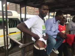 Umsekeli kaMnu Douglas Mwonzora uveza inxeba athi utshaywe khona ngabasekeli bakaMnu Nelsn Chamisa
