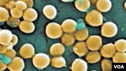 Medicina: Otkrivena nova, teško liječiva baktertija