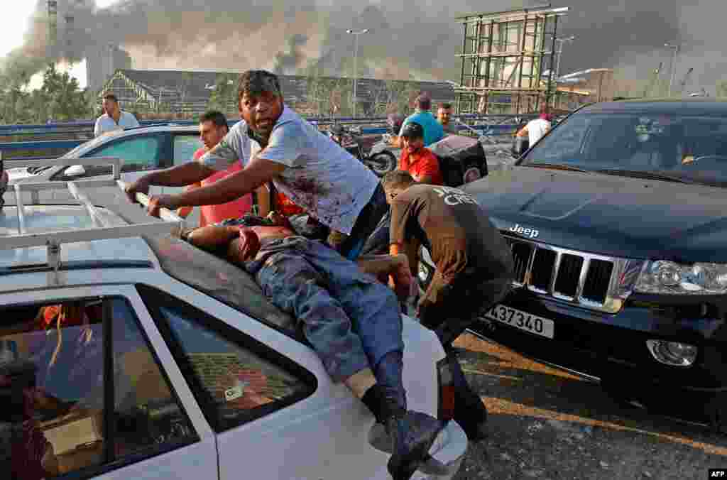 An injured man lies at the back of a car before being rushed away from the scene of a massive explosion at the port of Lebanon&#39;s capital Beirut, Aug. 4, 2020. 