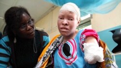Report on Albinism Filed By Loirdham Moyo