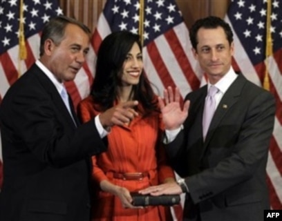 Anal dilator porno onlayn