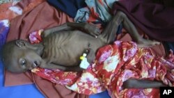 Abdihakin Omar 3, a malnourished child from southern Somalia lies on the floor in Banadir hospital in Mogadishu, Somalia, July 21, 2011