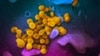 ვირუსი სარს-კოვ-2 მიკროსკოპის ქვეშ (ყვითლად), რომელიც იწვევს დაავადებას კოვიდ-19
