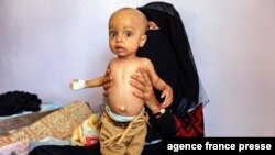 FILE - A woman holds a child suffering from malnutrition while sitting on a bed at a treatment center in al-Sabeen Maternal Hospital in the Houthi rebel-held Yemeni capital, Sanaa, June 22, 2019.