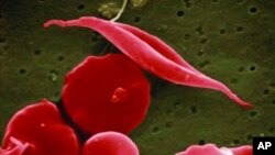 FILE - This electron microscope image provided by the National Institutes of Health in 2016 shows a blood cell altered by sickle cell disease, top.