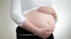 Lanzan registro mundial de embarazadas con Zika