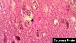 Ký sinh trùng amip ăn não Naegleria fowleri