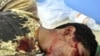 也門警察向抗議者開槍