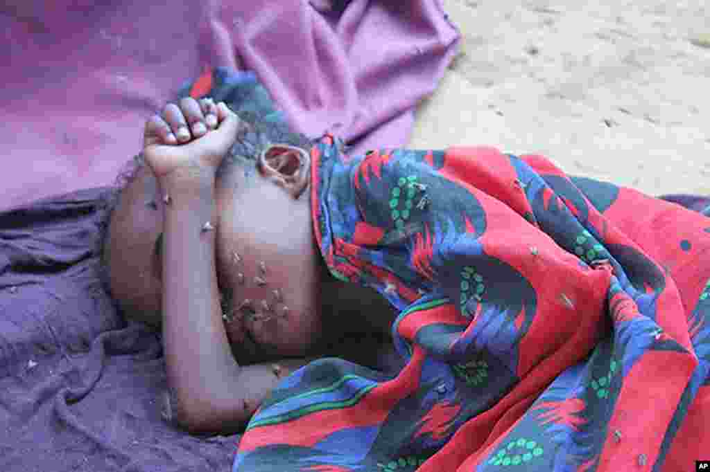 A very sick child lies covered with flies at a Mogadishu IDP camp. (VOA - P. Heinlein)