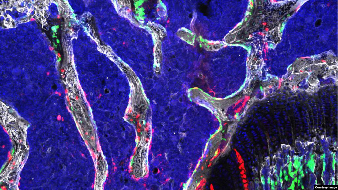 ARCHIVO- Una célula madre osteocondroretrinal (OCR), un tipo de célula madre ósea recientemente identificada que parece ser vital para el desarrollo esquelético y puede proporcionar la base para nuevos tratamientos para la osteoartritis, la osteoporosis y las fracturas óseas.