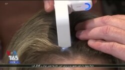 تازه های تکنولوژی/ ساخت یک ابزار جدید برای بهبود بهداشت موی سر