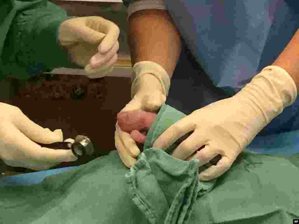 In this photo provided by the Smithsonian National Zoo, one of the giant panda cubs is examined by veterinarians after being born at the zoo on Aug. 22, 2015, in Washington. (Pamela Baker-Masson/Smithsonian&#39;s National Zoo)