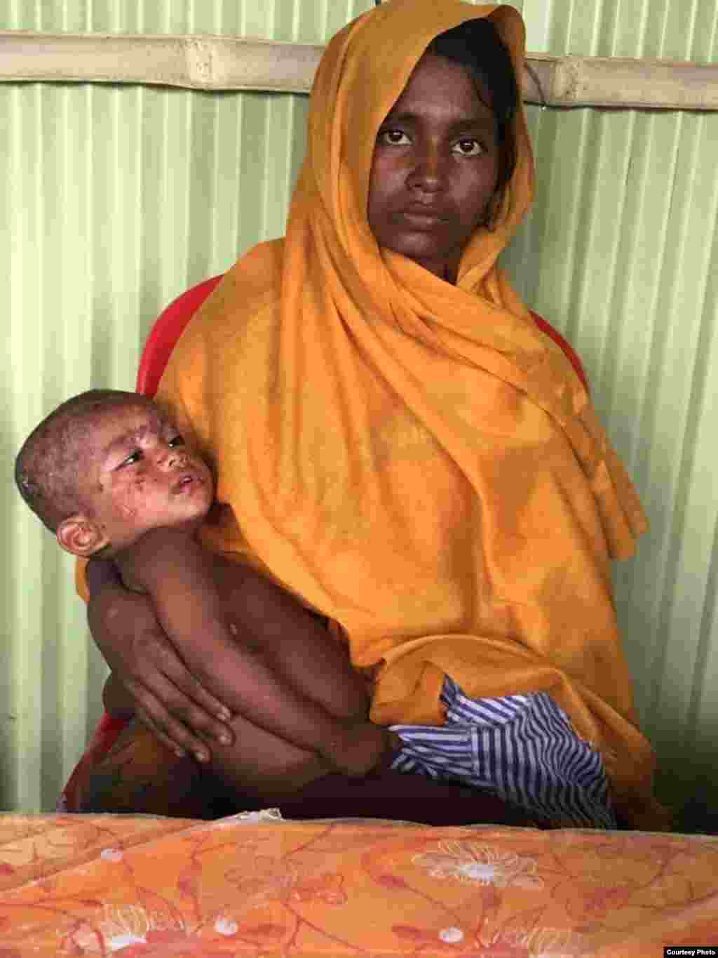 Seorang perempuan menggendong anak yang sakit di kamp pengungsi Rohingya di Bangladesh. (Foto: Dr. Imran Akbar)