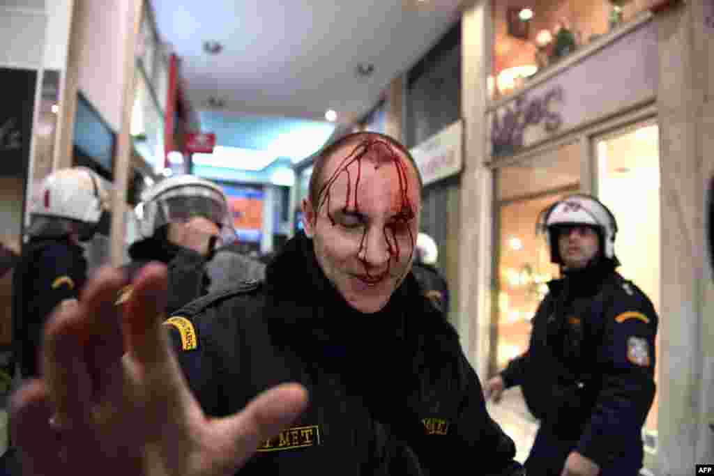 A riot policeman bleeds during clashes with demonstrators protesting against the government&rsquo;s decision to amend the law on strikes, in Athens, Greece.